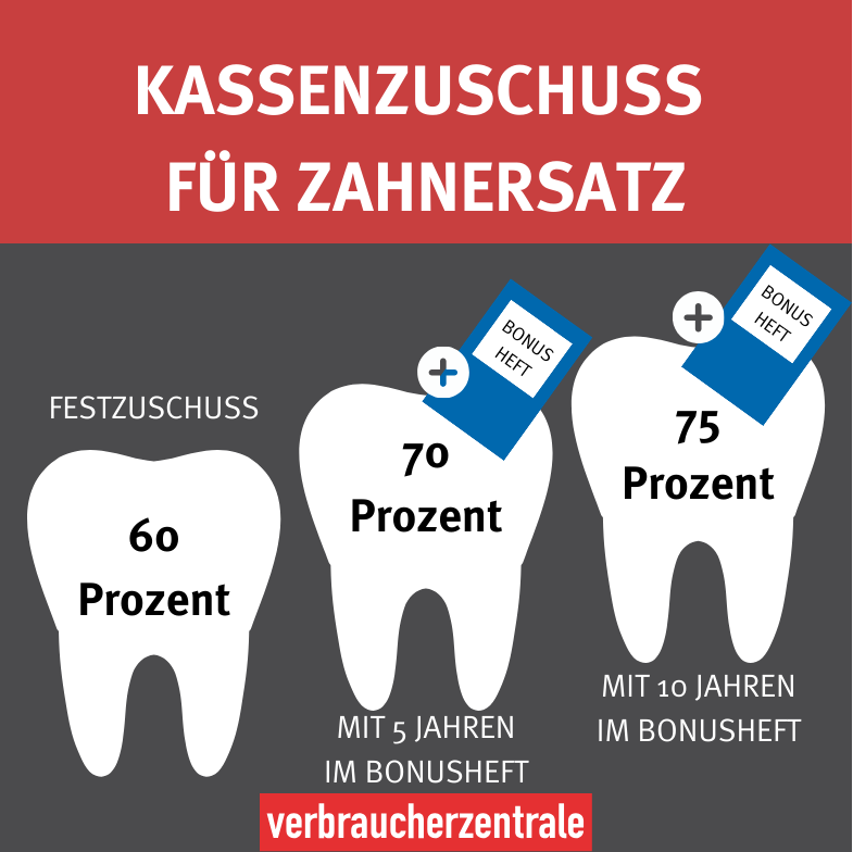 Kassenzuschuss für Zahnersatz